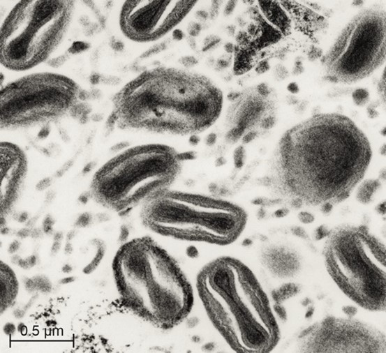 Cấu trúc virus FPV